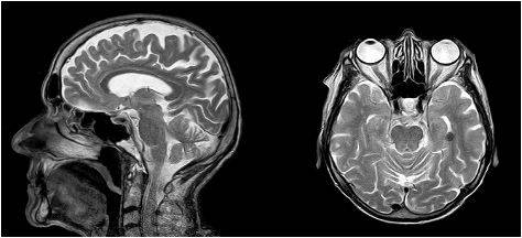 Магнитно-резонансная томография позволяет выявить патологию на ранней стадии, что считается приоритетным в онкологии и неврологии